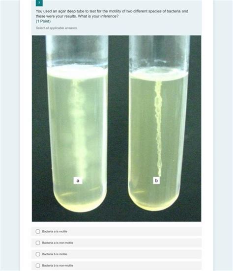 soft agar deep tests for what type of media|Observing Motility and Selective Media Study Guide .